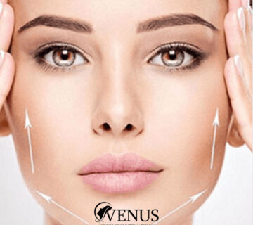 زاویه سازی صورت در کرج