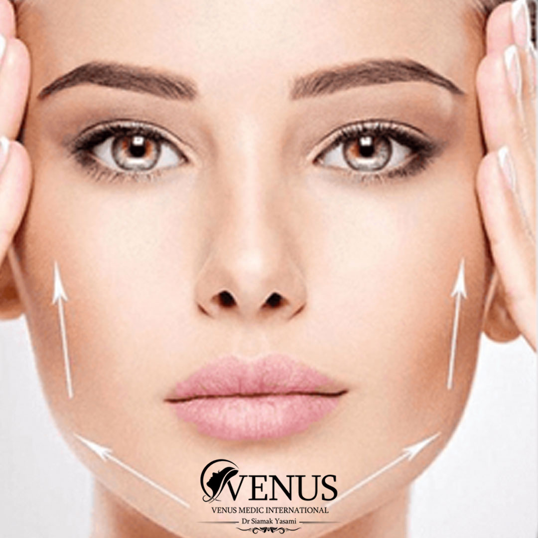 زاویه سازی صورت در کرج