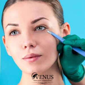 پرداخت اقساطی خدمات زیبایی در کرج | کلینیک زیبایی ونوس چهارراه طالقانی
