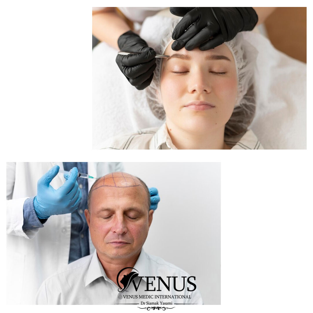 کاشت مو و ابرو در کرج