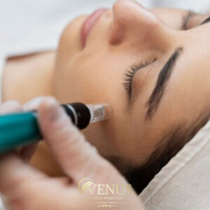 مزونیدلینگ در کرج