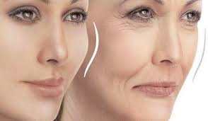 تزریق چربی به صورت - بیکینی در کلنیک زیبایی ونوس