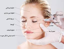 تزریق ژل و بوتاکس-کلنیک -ونوس کرج-طالقانی