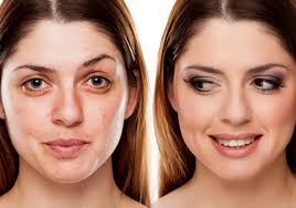 زاویه سازی صورت زاویه سازی صورت کلینیک ونوس کرج چهارراه طالقانی 