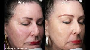 فیشال بادی در کلنیک ونوس-کرج چهارراه طالقانی