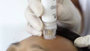 مزوتراپی کلنیک ونوس کرج- چهارراه طالقانی