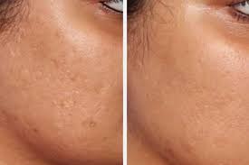 میکرودرم کلنیک ونوس کرج چهارراه طالقانی