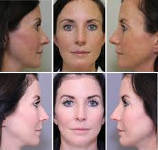 جوان‌سازی پوست  کلینیک فوق‌تخصصی ونوس کرج