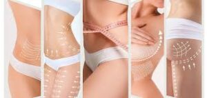 پرولیفت صورت -و بدن در کرج - بدون جراحی-کلنیک ونوس