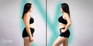 پرولیفت صورت و بدن-کلنیک -زیبایی ونوس کرج طالقانی