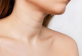 رفع خطوط گردن-کلنیک -زیبایی -ونوس