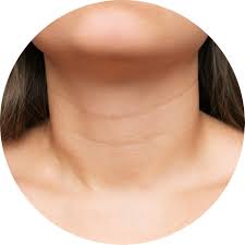 رفع خطوط -گردن-کلنیک -زیبایی -ونوس