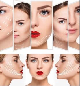 لنلوما چیست؟