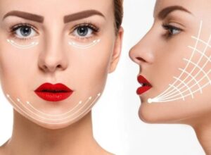 لنلوما چیست؟